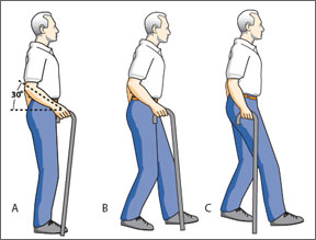 How To Choose-And Use-A Cane And Walker - Arthritis Advisor