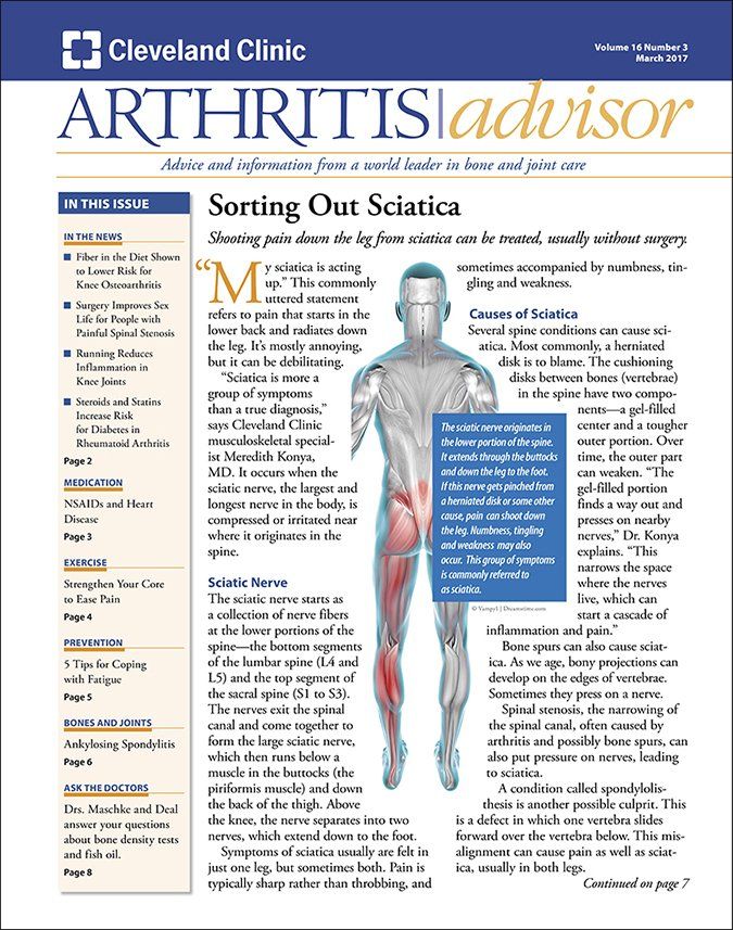 Download the Full March 2017 Issue PDF Arthritis Advisor