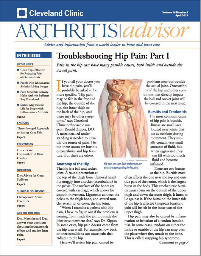 Download the Full April 2017 Issue PDF Arthritis Advisor