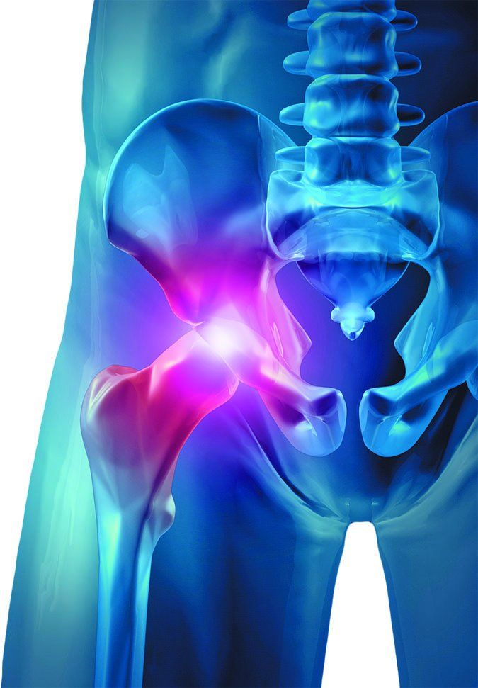 pain from hip to knee