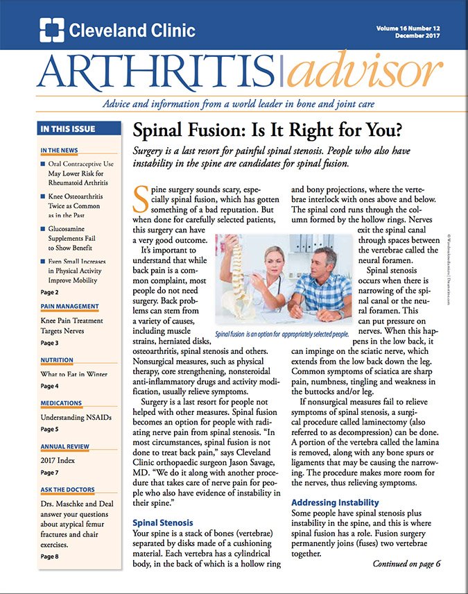 Download The Full December 2017 Issue PDF Arthritis Advisor
