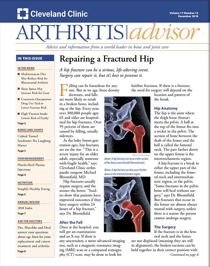 Download The Full December 2018 Issue PDF Arthritis Advisor