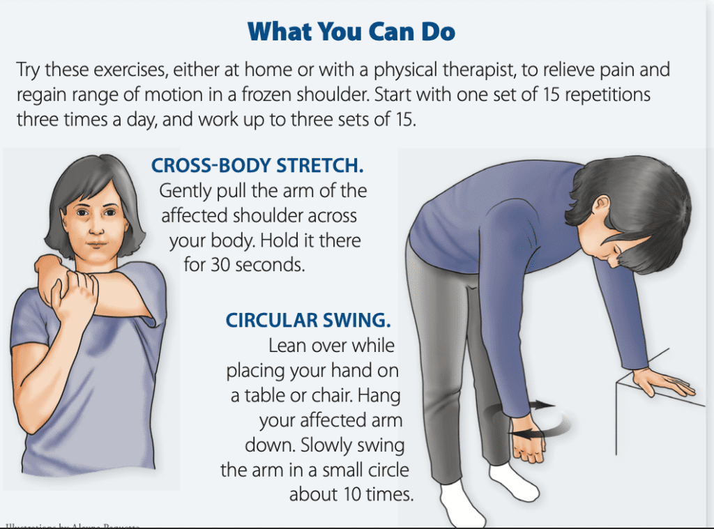 How to Fix a Frozen Shoulder - Arthritis Advisor