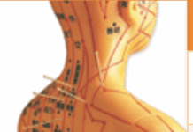 Is Community Acupuncture for You?